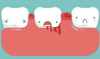  牙银炎怎样治疗 三种治疗方法分享